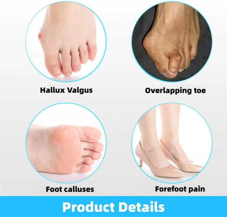 2pcs=1pair Toe Separator Hallux Valgus Corrector Finger Bunion Orthotics Protector Overlapping Forefoot Pad Foot Care Pedicure