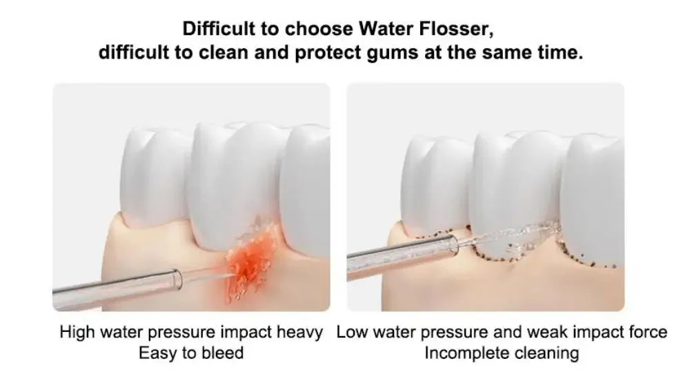 XIAOMI MIJIA MEO705 Portable Oral Irrigator Dental Teeth Whitening Flosser Bucal Tooth Cleaner Waterpulse Water Thread for Teeth
