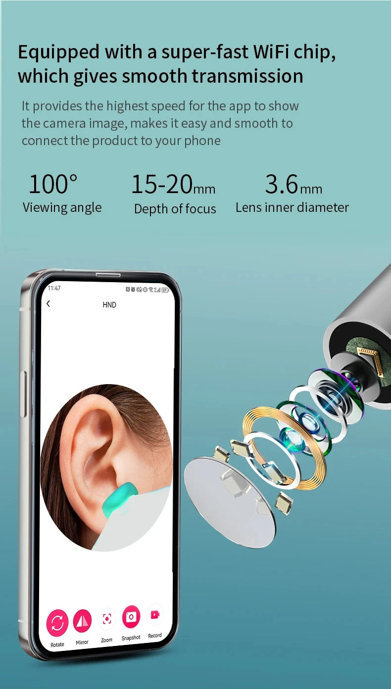 Nettoyant auriculaire visuel intelligent avec caméra, dissolvant de cérumen, otoscope 1080P HD, curette auriculaire, endoscope auriculaire, soins personnels