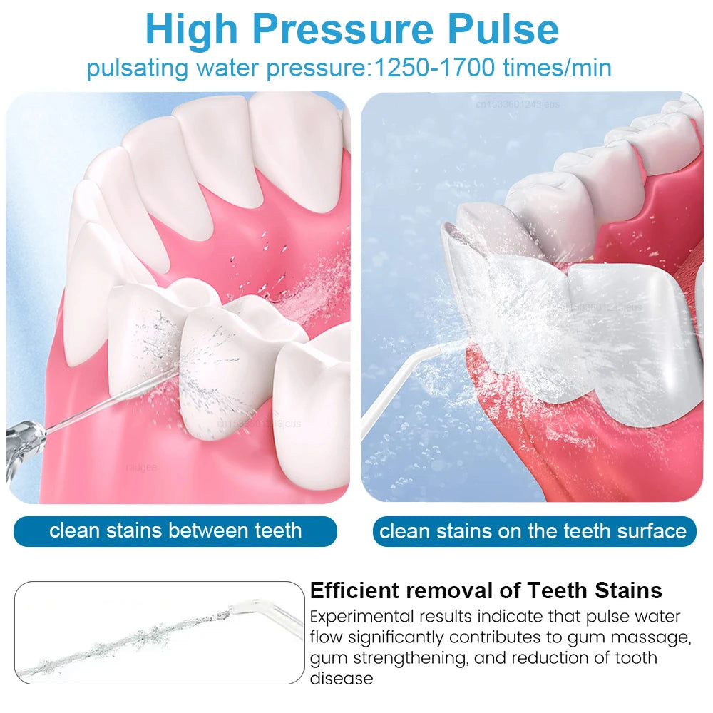 Oral Irrigator Dental Water Flosser for Teeth High Pressure Electric Dental Irrigator Water Flosser Mouth Washing Machine 800ML - Shoppiline