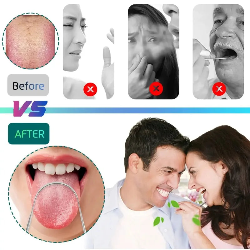 3PCS Stainless Steel Tongue Scraper Professional Tongue Brush Cleaner for Removing Tongue Coating Oral Care Tool