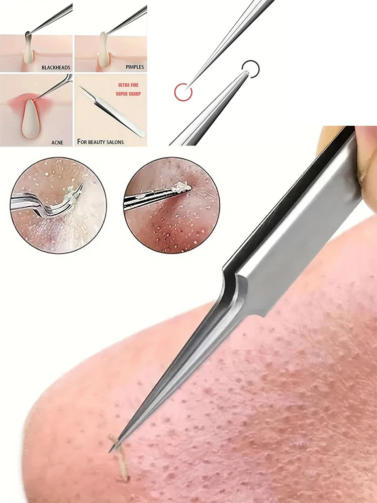 1 Pack Extra Fine No. 5 Cellular Acne Blackhead Tweezers - Facial Beauty Remove Acne Needle Tools for Skin Care