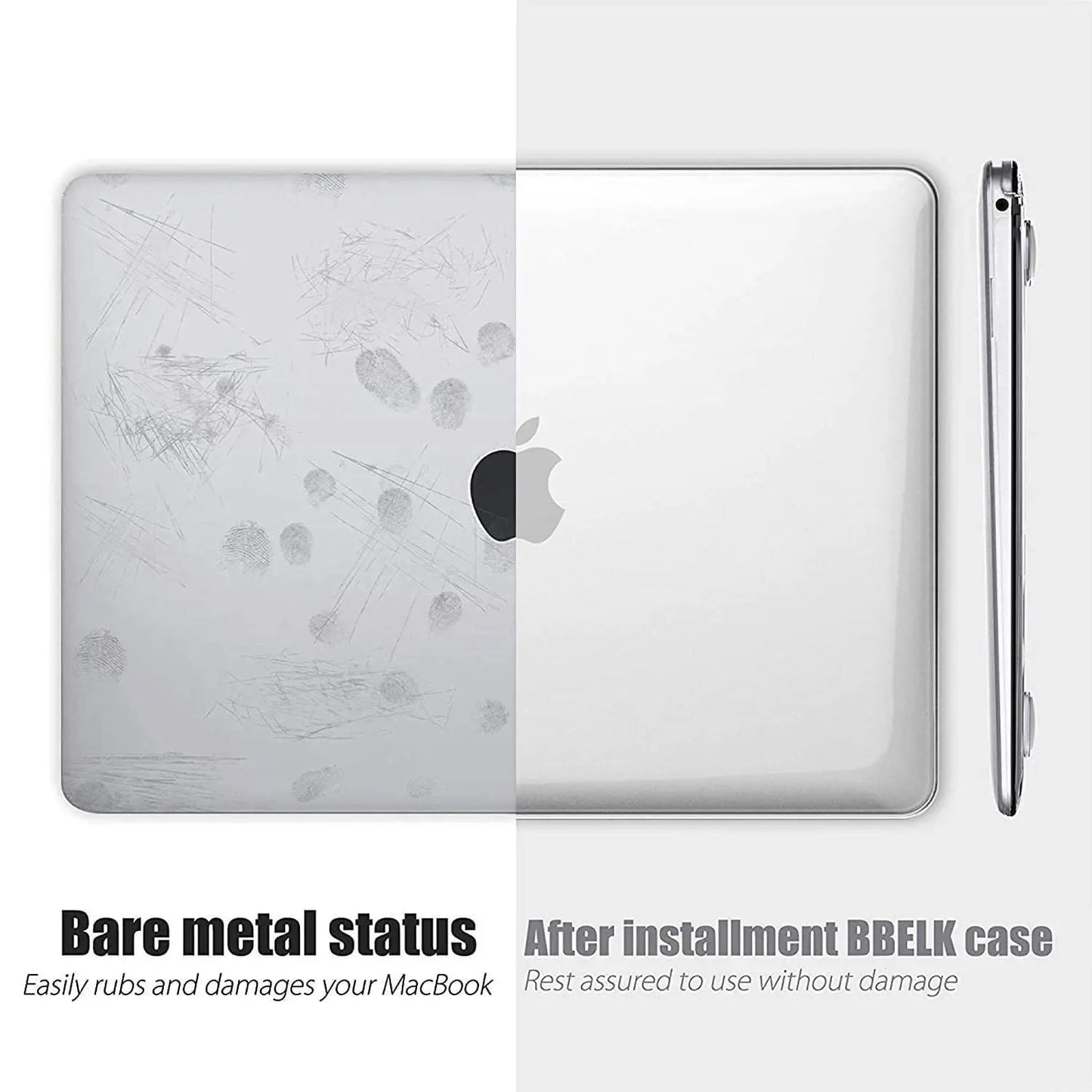 Laptop Case For Apple Macbook 13 13.6 Inch For M1 Chip Pro 13 A2338 Air 13 A2337 A2179 2022 M2 Air 13.6 Crystal Protective Cover