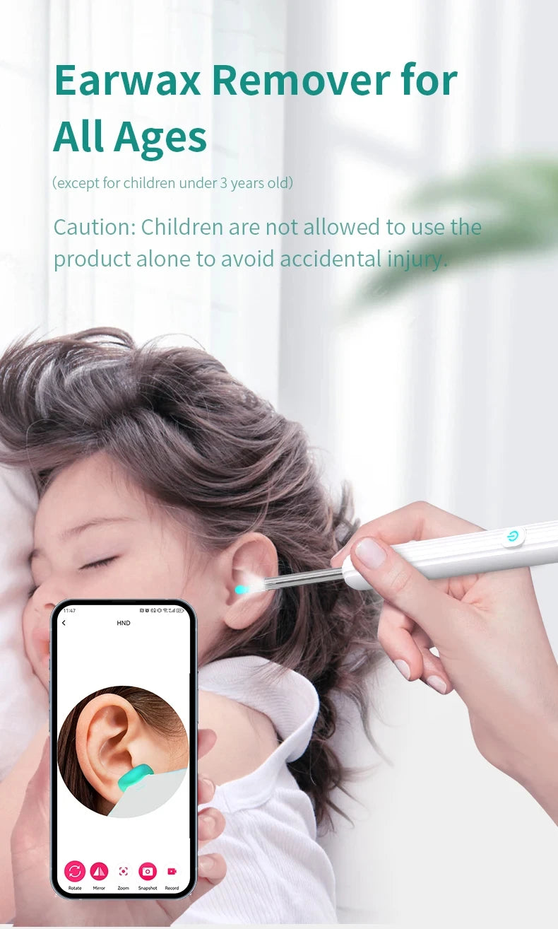 Nettoyant auriculaire visuel intelligent avec caméra, dissolvant de cérumen, otoscope 1080P HD, curette auriculaire, endoscope auriculaire, soins personnels